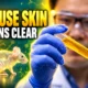 tartrazine mouse skin transparent human trial withdrawn